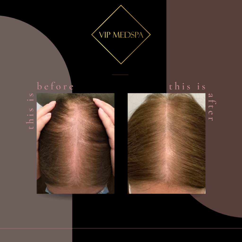 TED Hair Restorationa