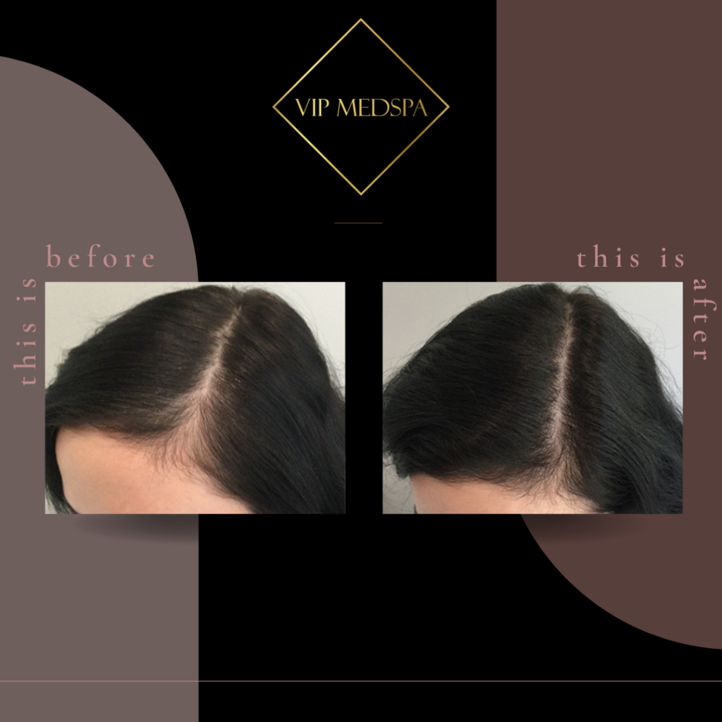 TED Hair Restoration