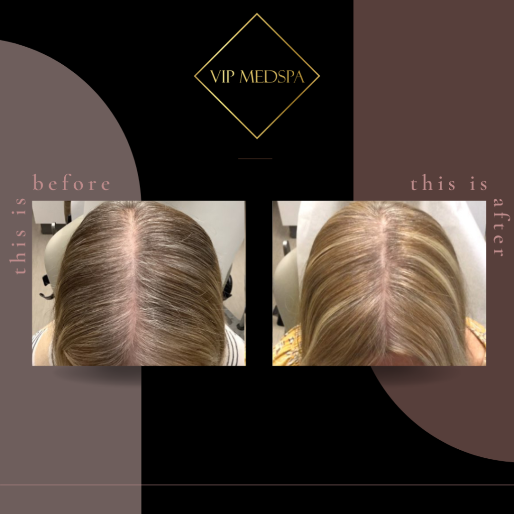 TED Hair Restoration