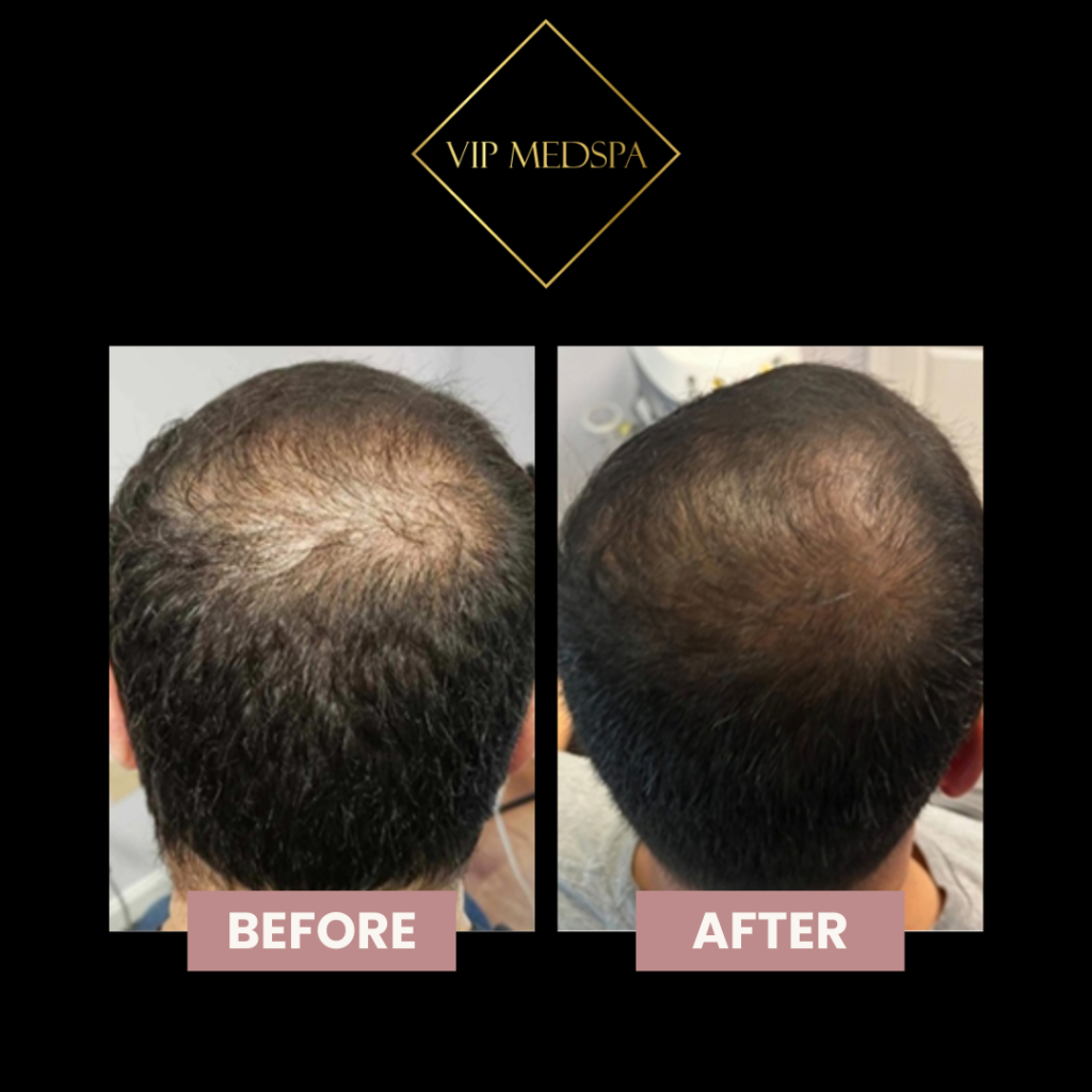 TED Hair Restoration