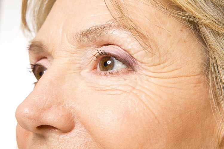 https://vipmedspa.ca/wp-content/uploads/2023/08/fine-lines-and-wrinkles.jpg